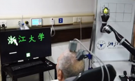 浙江大學腦機接口重大突破 高位截癱患者意念寫漢字
