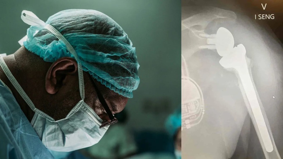 蘋果Vision Pro頭顯再次參與外科手術：可減少患者疼痛、縮短術後恢復時間